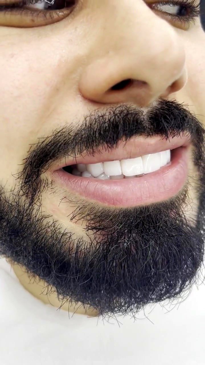 Marginal Seal & Gingival Papilla Integration Check